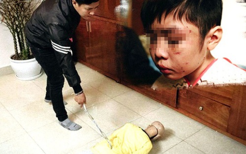 Vụ bé trai 10 tuổi bị bạo hành: Bố đẻ và 'dì ghẻ' lĩnh án tù