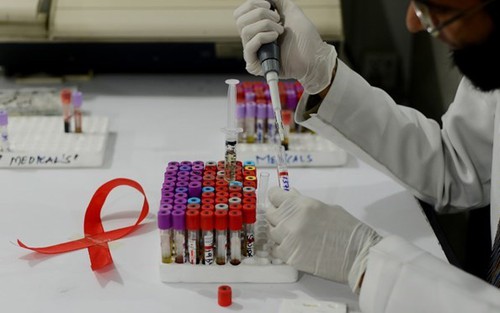 Israel xây dựng nhà máy công nghệ sinh học đầu tiên sản xuất thuốc mới điều trị AIDS