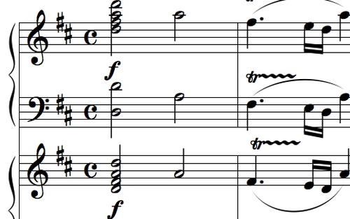 Phát hiện 'chìa khóa' trong bản nhạc của Mozart giúp xoa dịu người bệnh động kinh