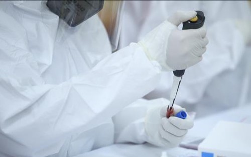 Nên xét nghiệm cả lao và COVID-19 khi có triệu chứng nghi ngờ