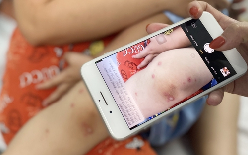 Không để dịch bệnh tay chân miệng bùng phát, lan rộng và kéo dài