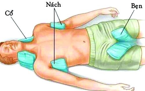 Cấp cứu thành công bệnh nhân hôn mê do say nắng
