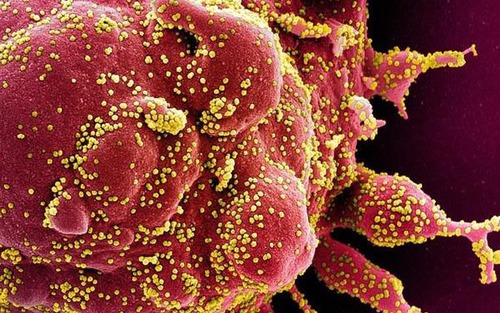 Phát hiện con đường xâm nhập khác của virus SARS-CoV-2 vào cơ thể người