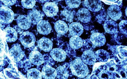 Ưu thế vượt trội của phương pháp mới xét nghiệm virus sử dụng cảm biến