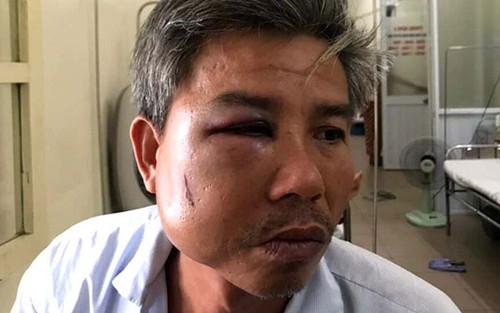 Khởi tố đối tượng gây thương tích nhân viên Trung tâm công viên cây xanh