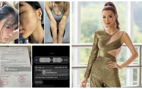 Người trong cuộc lên tiếng vụ siêu mẫu Khả Trang bị chồng chưa cưới bạo hành
