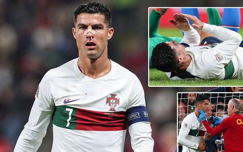Ronaldo chấn thương, mũi bê bết máu những vẫn 'chiến' hết mình cùng Bồ Đào Nha