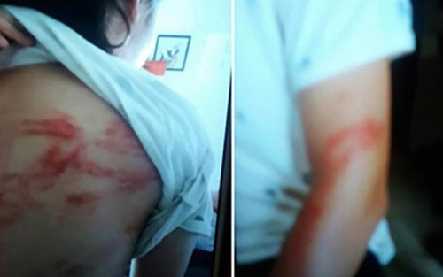 Bố đẻ bạo hành hai con dã man ngay giữa Thủ đô