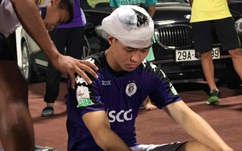 Duy Mạnh không bị chấn thương nặng vùng đầu