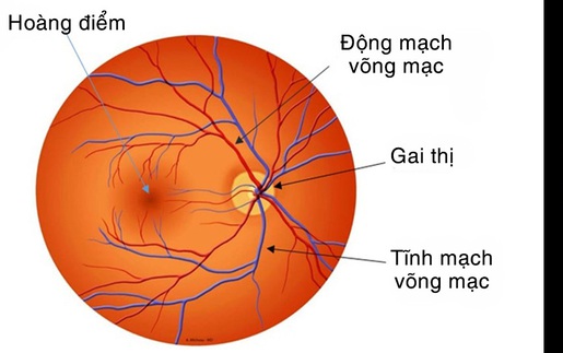 Tắc tĩnh mạch võng mạc 