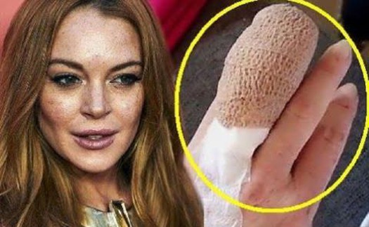 SỐC: Lindsay Lohan mất nửa ngón tay vì tai nạn