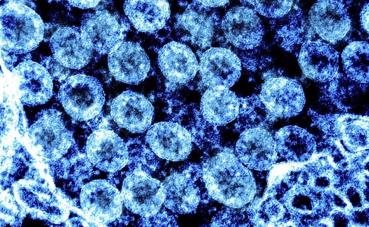 Các nhà khoa học Anh mở rộng giải trình tự gene đối với virus gây các bệnh hô hấp ngoài Covid-19