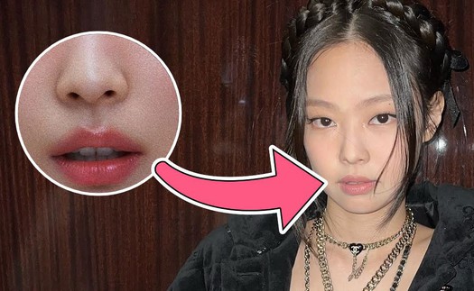 Lý do Jennie Blackpink được chọn là hình mẫu khi 'dao kéo'