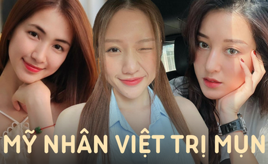 Mỹ nhân Vbiz từng 'khốn khổ' vì mặt mụn, giờ lấy lại phong độ đỉnh cao nhờ 'đúng thầy đúng thuốc' 