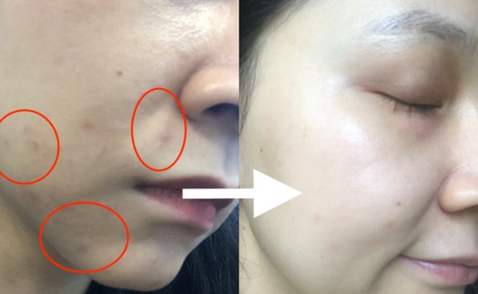 Dùng thử dầu dưỡng da giá 150k mà beauty blogger Trinh Phạm gợi ý: Lên da mịn mướt, vết thâm mờ hẳn sau vài ngày