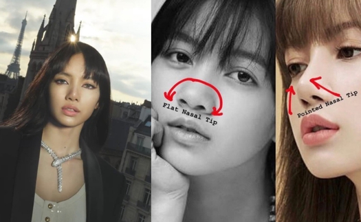 Netizen tranh cãi: Lisa Blackpink có sửa mũi hay không?