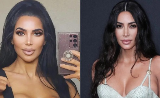 Nghiện phẫu thuật thẩm mỹ đến biến dạng,"bản sao" Kim Kardashian tử vong thương tâm