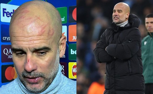 Dưới góc nhìn tâm lý học: Pep Guardiola tự cào mặt, làm đau chính mình và dấu hiệu của sự bất lực