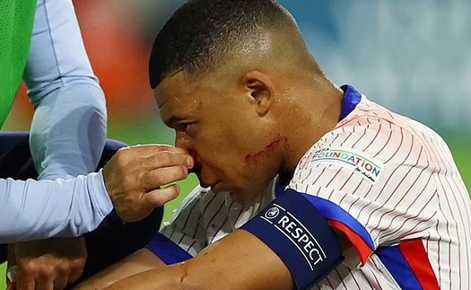 Báo Pháp cập nhật mới nhất tình trạng của Mbappe, phải ngồi ngoài lâu hơn dự kiến 