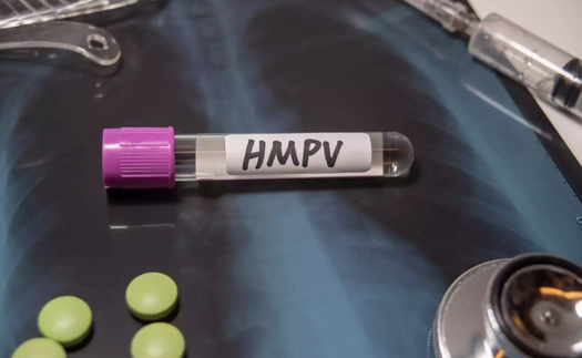 Nga xác định các nhóm nguy cơ nhiễm virus HMPV