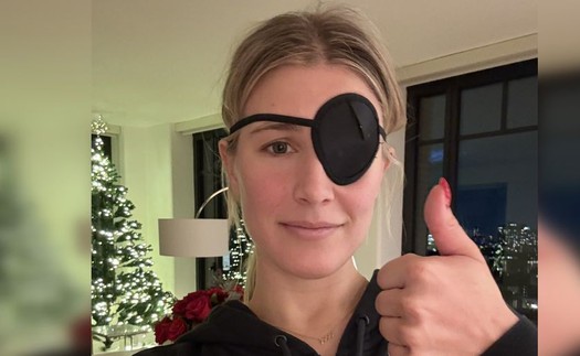 Hơn 3000 ca chấn thương mắt vì chơi pickleball, bác sĩ Mỹ khuyến cáo dùng kính bảo hộ vì quả bóng bay quá nhanh