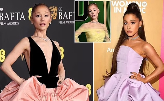 Ariana Grande bất ngờ đăng tải hình ảnh gầy gò đáng báo động