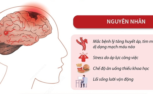 Cảnh báo đột quỵ ở người trẻ tuổi
