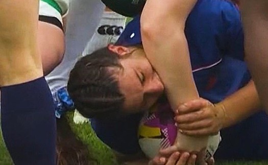 Cầu thủ nữ bị cáo buộc cắn đối thủ ở tứ kết World Cup