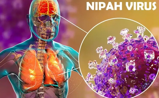 Việt Nam chưa xuất hiện ca mắc virus Nipah, Bộ Y tế sẵn sàng các biện pháp ứng phó