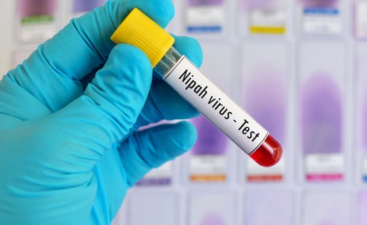 Ấn Độ ghi nhận ca tử vong do virus Nipah