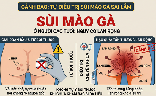Sùi mào gà ở người cao tuổi: Xấu hổ tự điều trị hay đối mặt nguy cơ lan rộng khó lường?