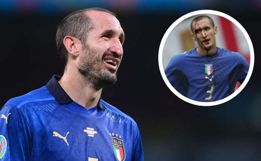 Nhận định Anh vs Ý (VTV3 trực tiếp): Chiellini đã sẵn sàng cho trận chiến cuối