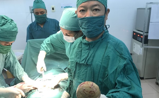 Lấy thành công viên sỏi gần nửa kg khỏi bàng quang bệnh nhân