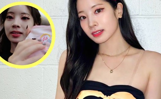 3 thứ phải có khi Dahyun Twice đi du lịch: Món cuối gây xúc động