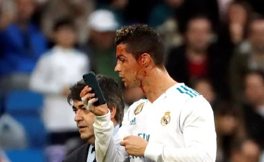 Máu chảy bê bết, Ronaldo vẫn thản nhiên dùng điện thoại để... soi gương