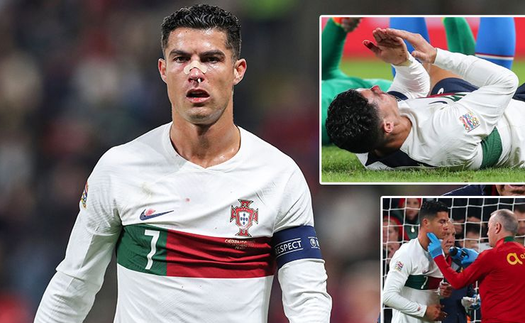 Ronaldo chấn thương, mũi bê bết máu những vẫn 'chiến' hết mình cùng Bồ Đào Nha